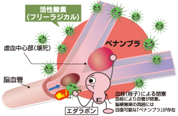 脳保護療法 主な薬(エダラボン)