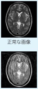 正常な画像と正常に映らない画像の比較