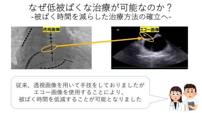 被ばく時間を減らした治療方法の確立へ