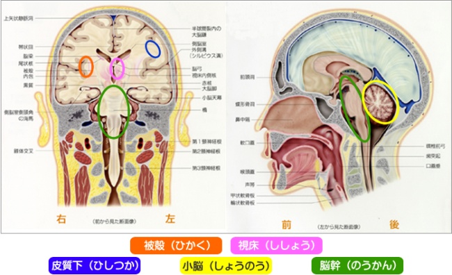 被殻、視床、皮質下、小脳、脳幹